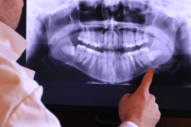 Best Emergency Treatment for Toothache in Long Beach, IN